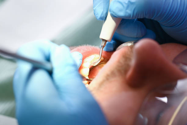 Best Urgent Care for Lost Fillings or Crowns in Lake Murray Of Richland, SC